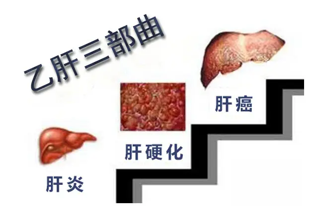 健康人感染乙肝的幾率是多少？